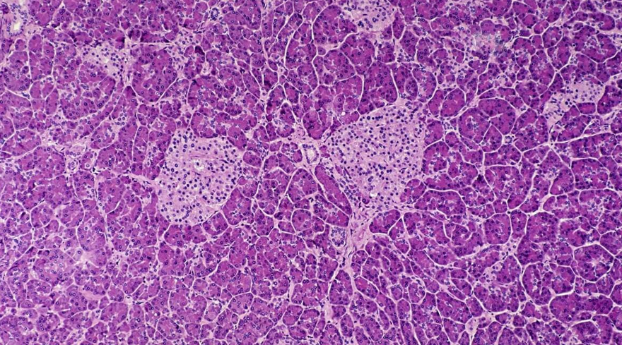 فعالسازی مجدد سلولهای بنیادی پانکراس در بیماران مبتلا به دیابت تیپ ۱ برای تولید انسولین